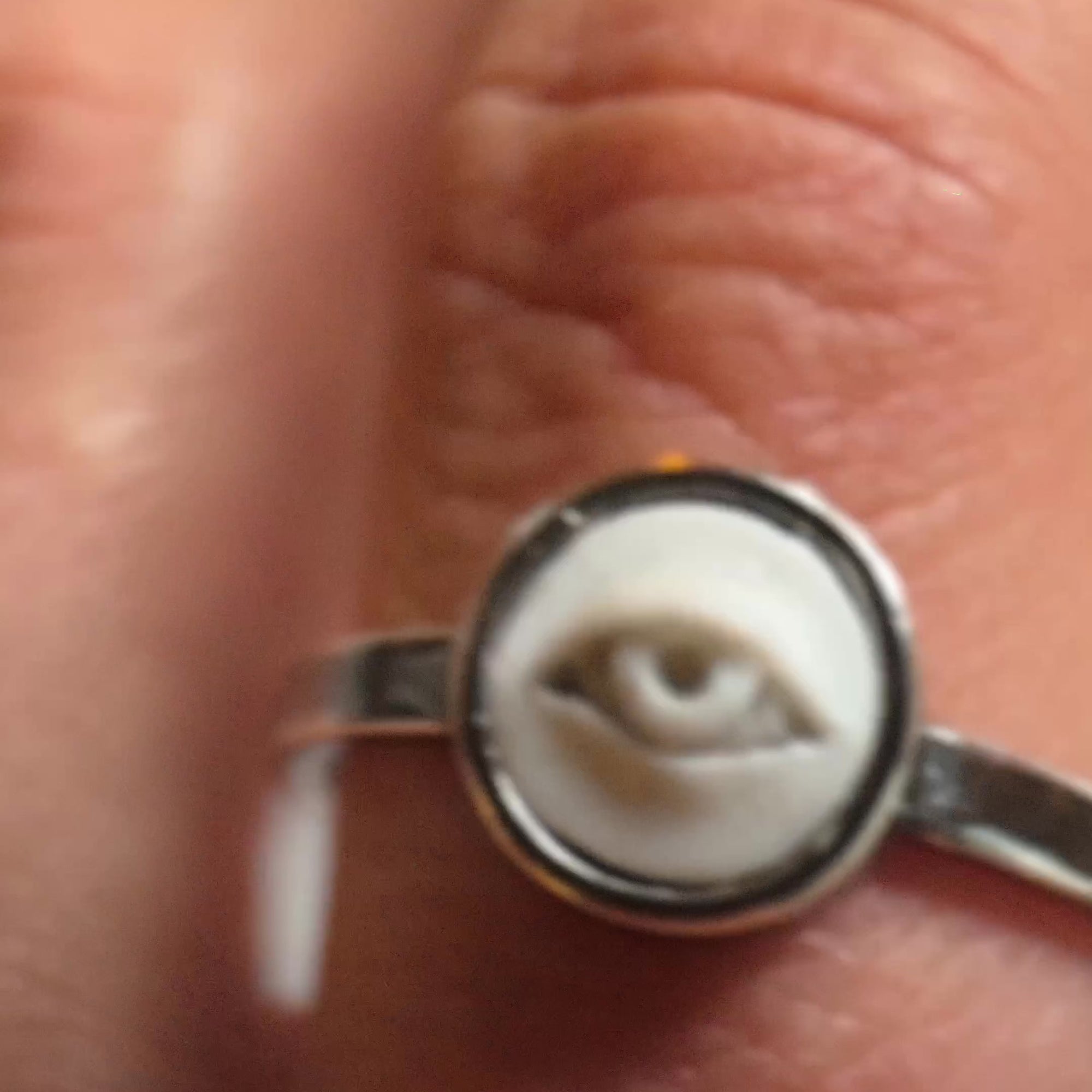 Eye ring